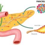 Understanding ISLET Cells: The Key to Diabetes Treatment